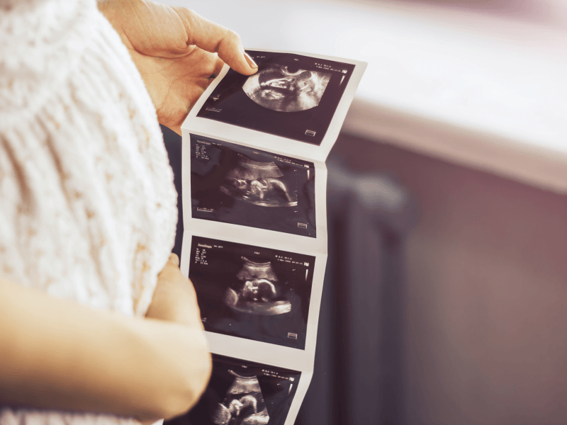 AdobeStock 192616431